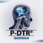 pdtr serbia